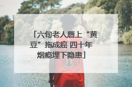 六旬老人唇上“黄豆”拖成癌 四十年烟瘾埋下隐患